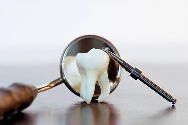 人工牙冠是怎么装到种植牙根上的？安装牙冠，通常都需要这5步-第2张图片-太平洋在线下载